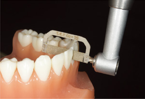 Accurate proximal exfoliation with Proximal Stripper