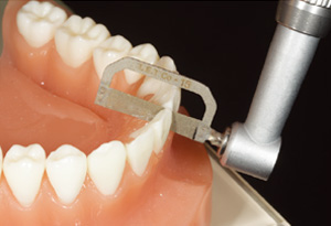 The best quality of a Proximal Stripper