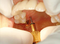 SHORT HAND DRIVER Process 2