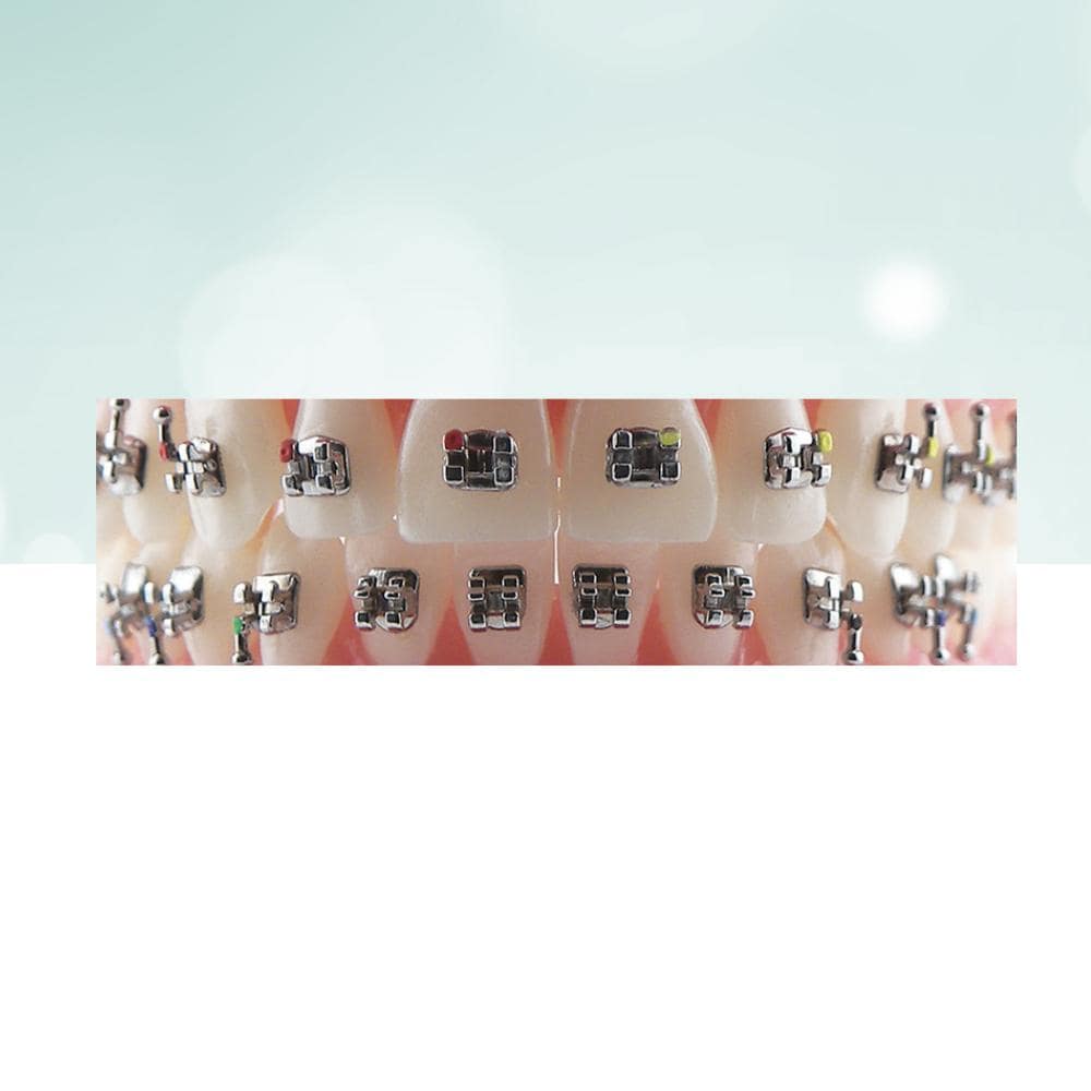 Metal Bracket Archist-1 Bracket